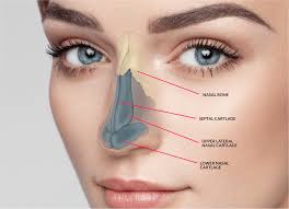 Rhinoplasty Surgery in Hisar